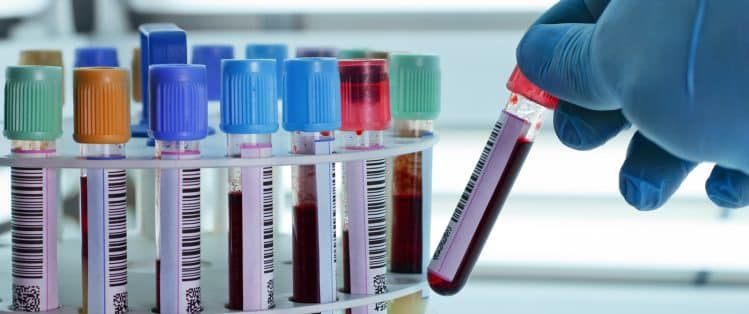 Faire une analyse au CMM Labo