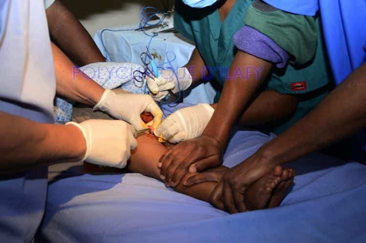 Soins chirurgicaux à la Polyclinique d'Ilafy
